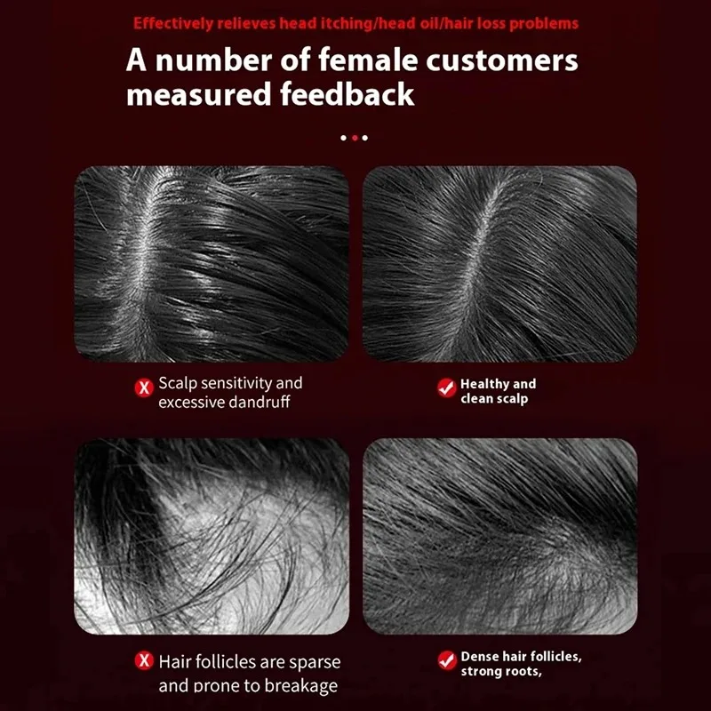 Electric Vibration Massage Com - Scalp Massager Electric avis et prix
