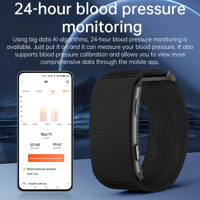 VWAR Loop X ECG Smart Bracelet - Xbody Health & Wellness Functional Integrative Medicine Office & Medical Spa Reviews avis et prix