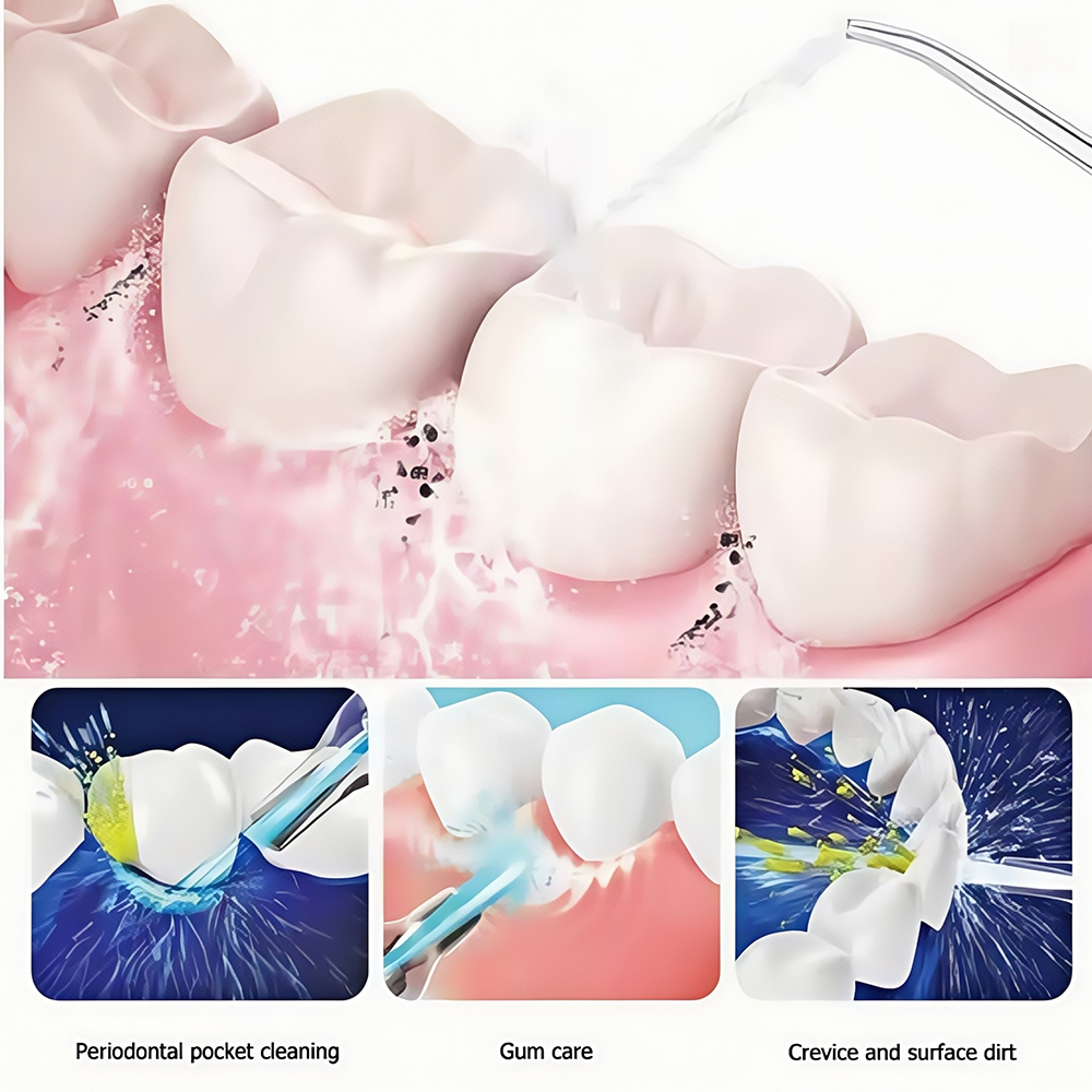 Portable High-Pressure Oral Ir - Oral Irrigator Flosser avis et prix