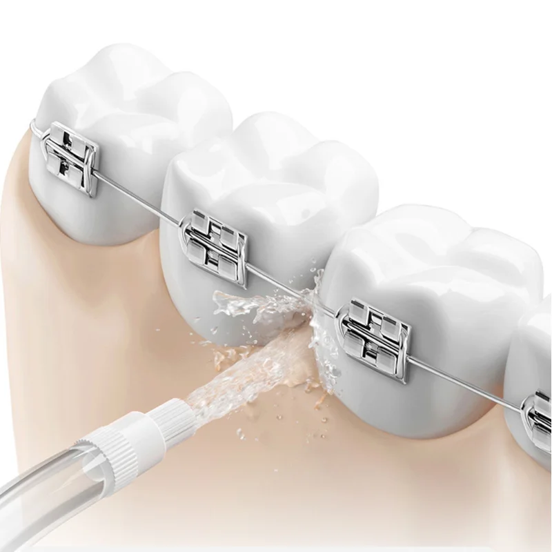 Original Nozzles for all Xiaom - Oral Irrigator Flosser avis et prix