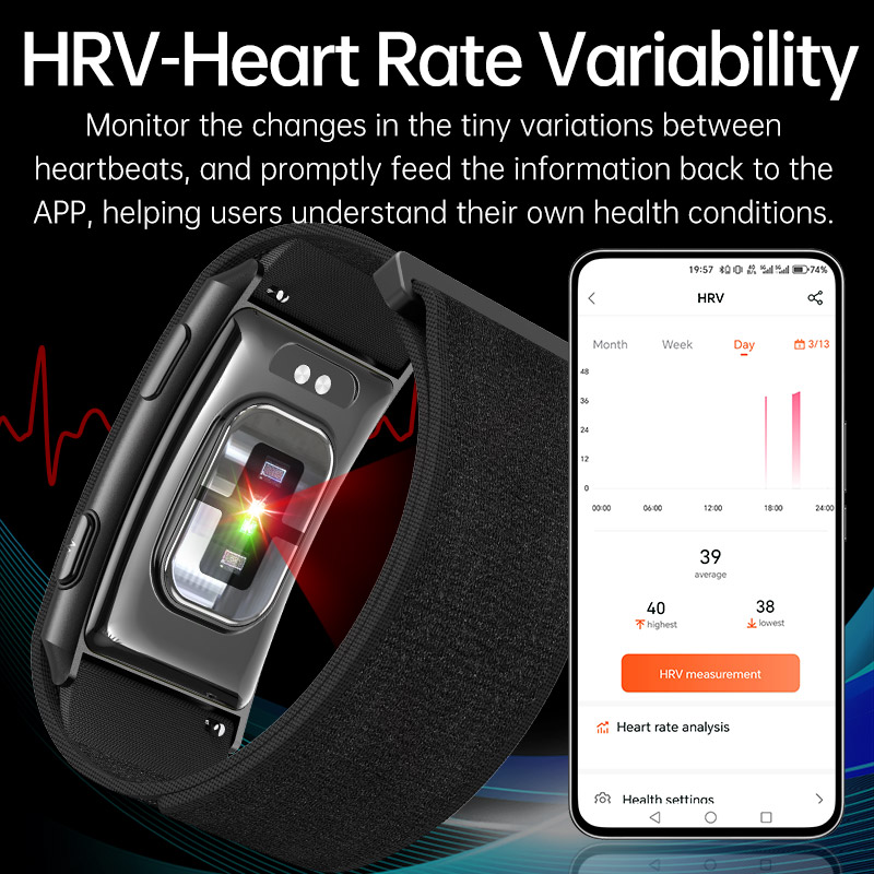 VWAR LOOP X ECG Smart Bracelet - Xbody Health & Wellness Functional Integrative Medicine Office & Medical Spa Reviews avis et prix